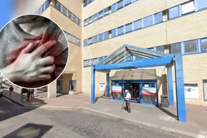 NHS Launches Cardiac Clinical Trial to Improve Heart Care Hammersmith 2026